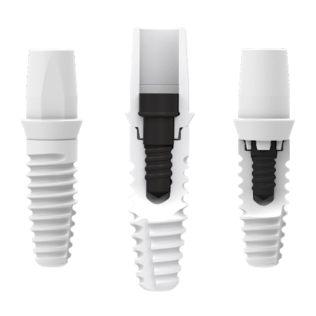 Zeramex XT Ceramic Implant System
