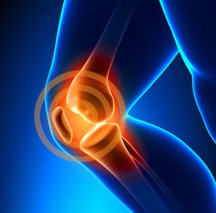 kneeallergy