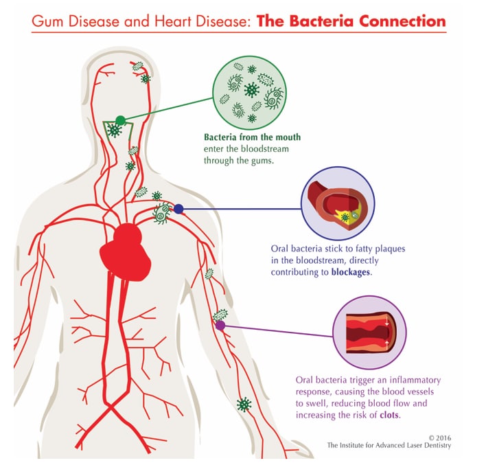 oral health and heart