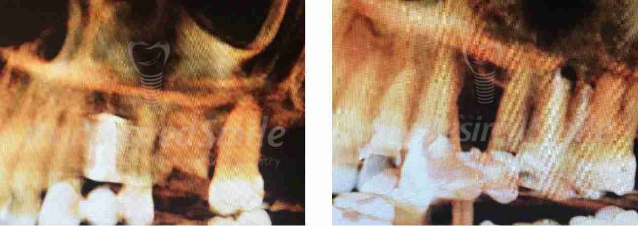 ZERAMEX Case Dr. Alicea Image 4