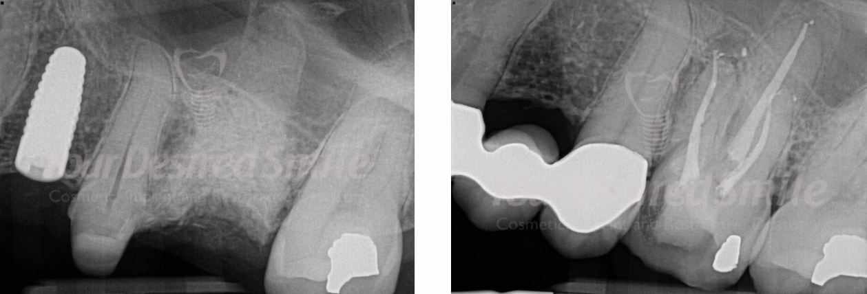 ZERAMEX Case Dr. Alicea Image 6
