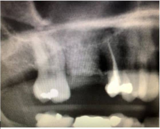 Augma 8