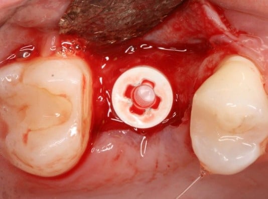 Toffler Case Presentation Picture 8