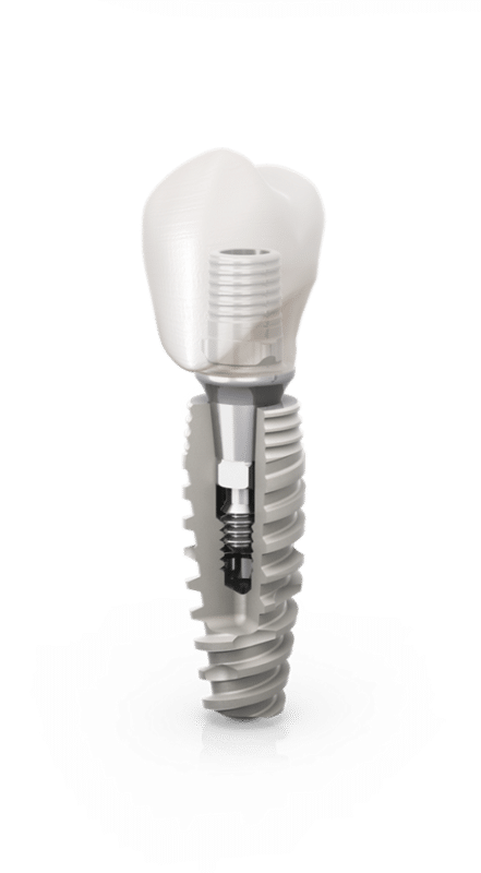 Buy Osstell SmartPeg for Neodent - Emerginnova