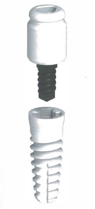 6 to 9 Zeramex Docklocs Abutments 1